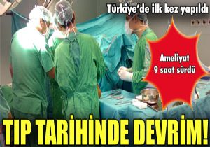 Trkiye de ilk yz nakli ameliyat baaryla yapld